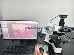 顯微鏡攝像頭MHD2000適配奧林巴斯BX51升級(jí)用于病理診斷拍攝