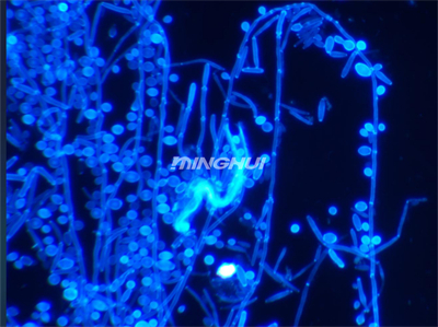 明慧UB203i-FL真菌熒光顯微鏡+MHD600顯微相機(jī)實(shí)拍效果圖