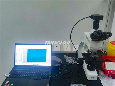 真菌熒光顯微鏡系統(tǒng)UB203i-FL和MHD600助力湖南某醫(yī)院真菌檢測(cè)