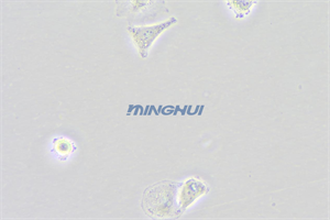 倒置顯微鏡MHIL200和MHD600相機應(yīng)用于食管鱗癌觀察（中山大學(xué)）