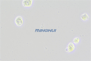 倒置顯微鏡MHIL200和MHD600相機應(yīng)用于食管鱗癌觀察（中山大學(xué)）
